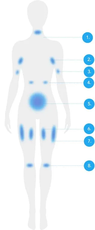 CoolSculpting treatable areas